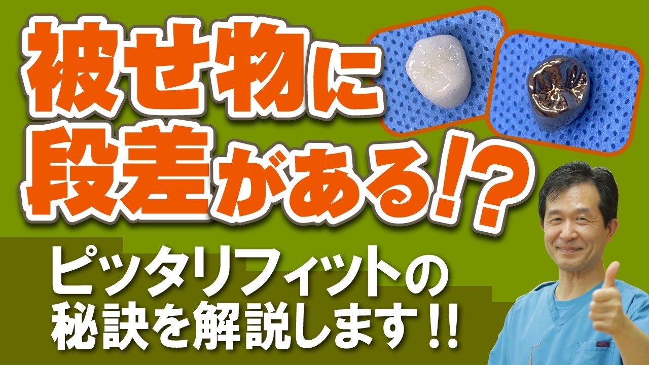 被せ物に段差がある！？ ピッタリフィットの秘訣を解説!!