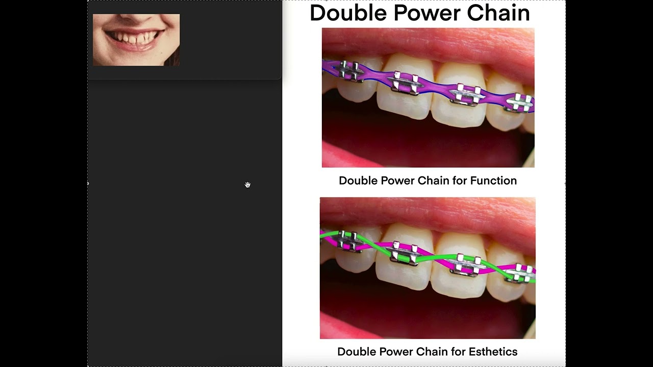 Double Power Chain- Risks- When to Use It
