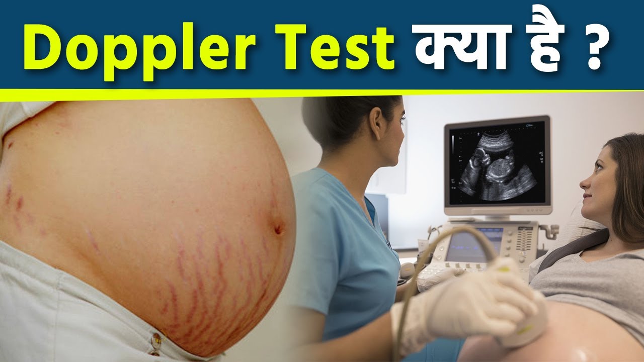 Doppler Ultrasound Kya Hai | Color Doppler Ultrasound Kyu Kiya Jata Hai | Boldsky