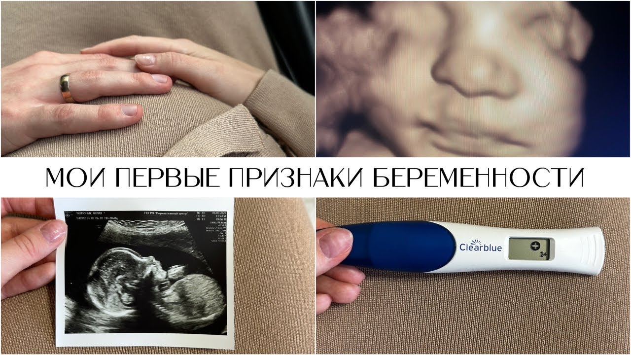 Мои первые признаки беременности I Реакция мужа I 1 триместр