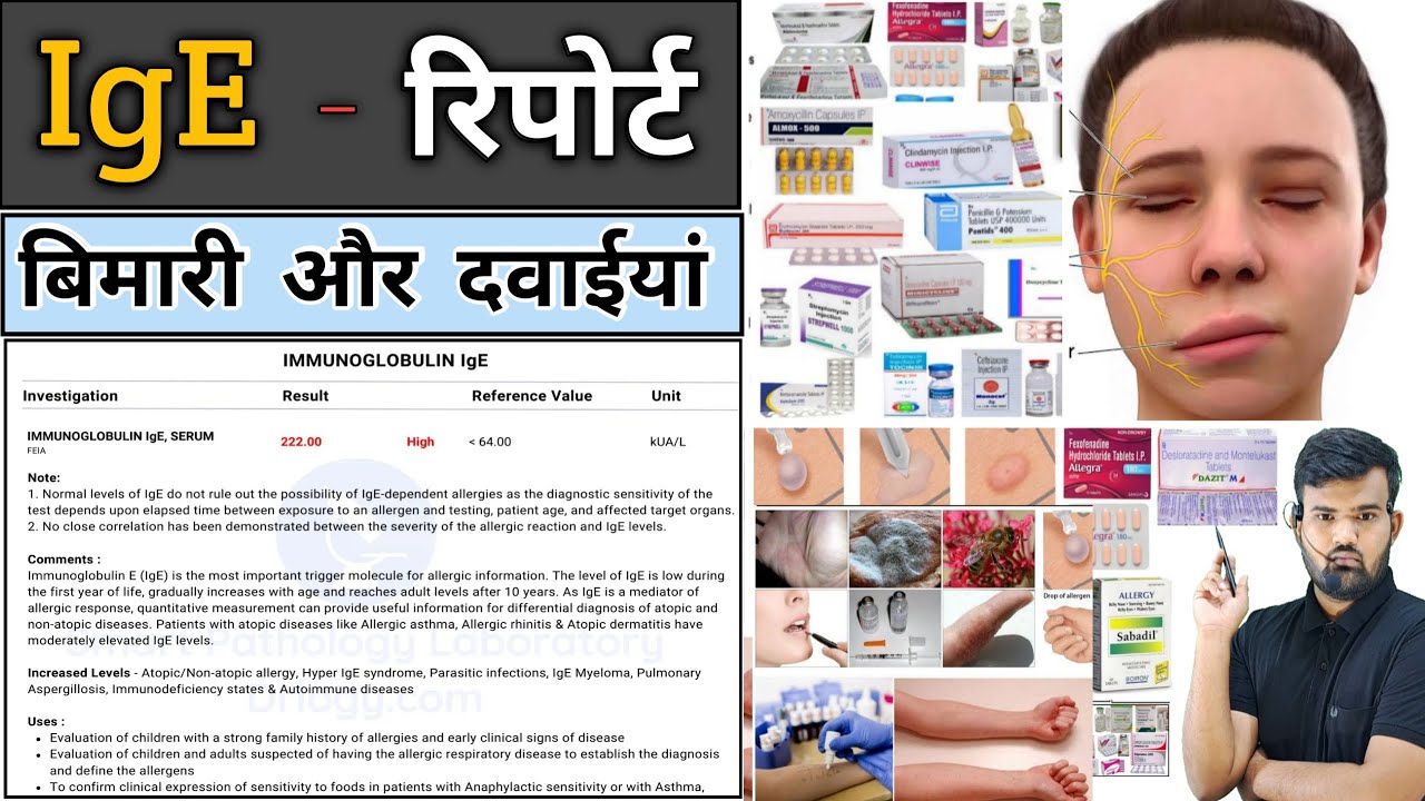IgE रिपोर्ट | Medicine | Medicine Knowledge | Treatment | Disease | Infection | Allergy | Doctor