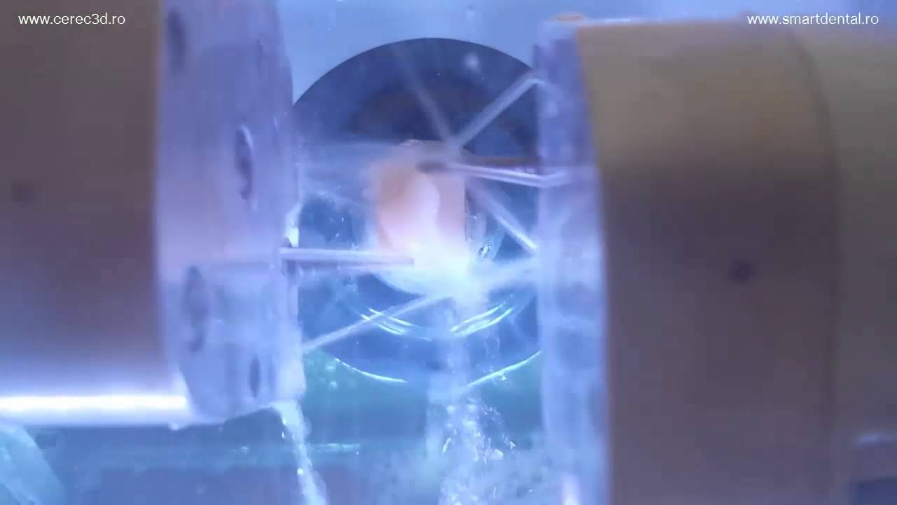 CEREC Omnicam MCXL -ceramic inlay onlay milling - Cluj Napoca
