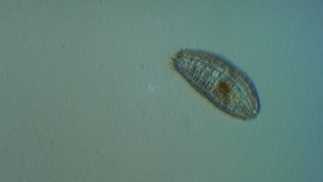 Ciliate: Coleps sp.
