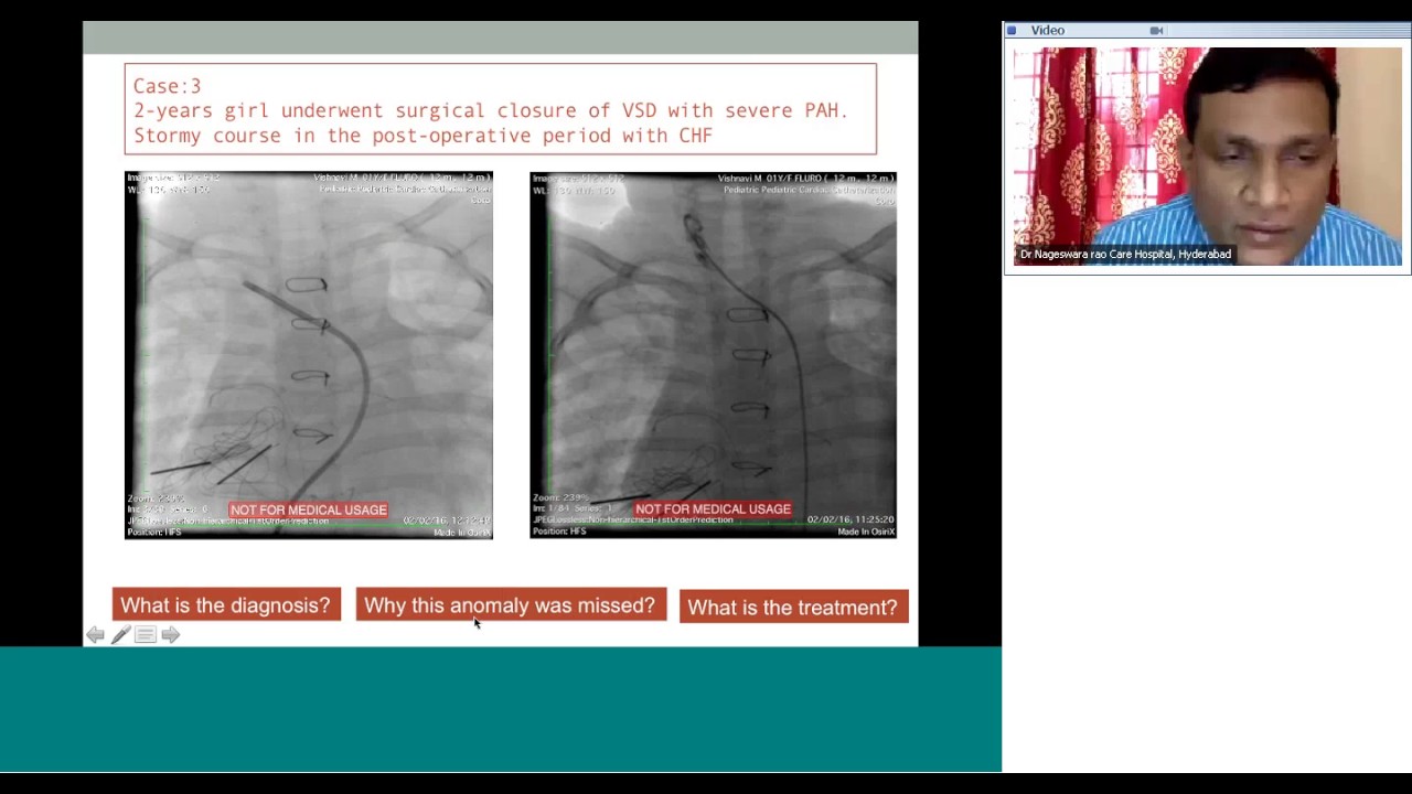 Diagnostic and interventional angios quiz by Dr Nageswara Rao