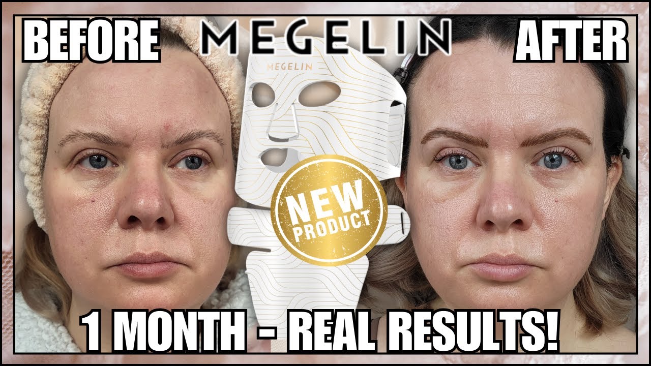 NEW Megelin Laser LED Mask Review | Does It Really Work? 1 Month Real Results🔥✨ | Clare Walch