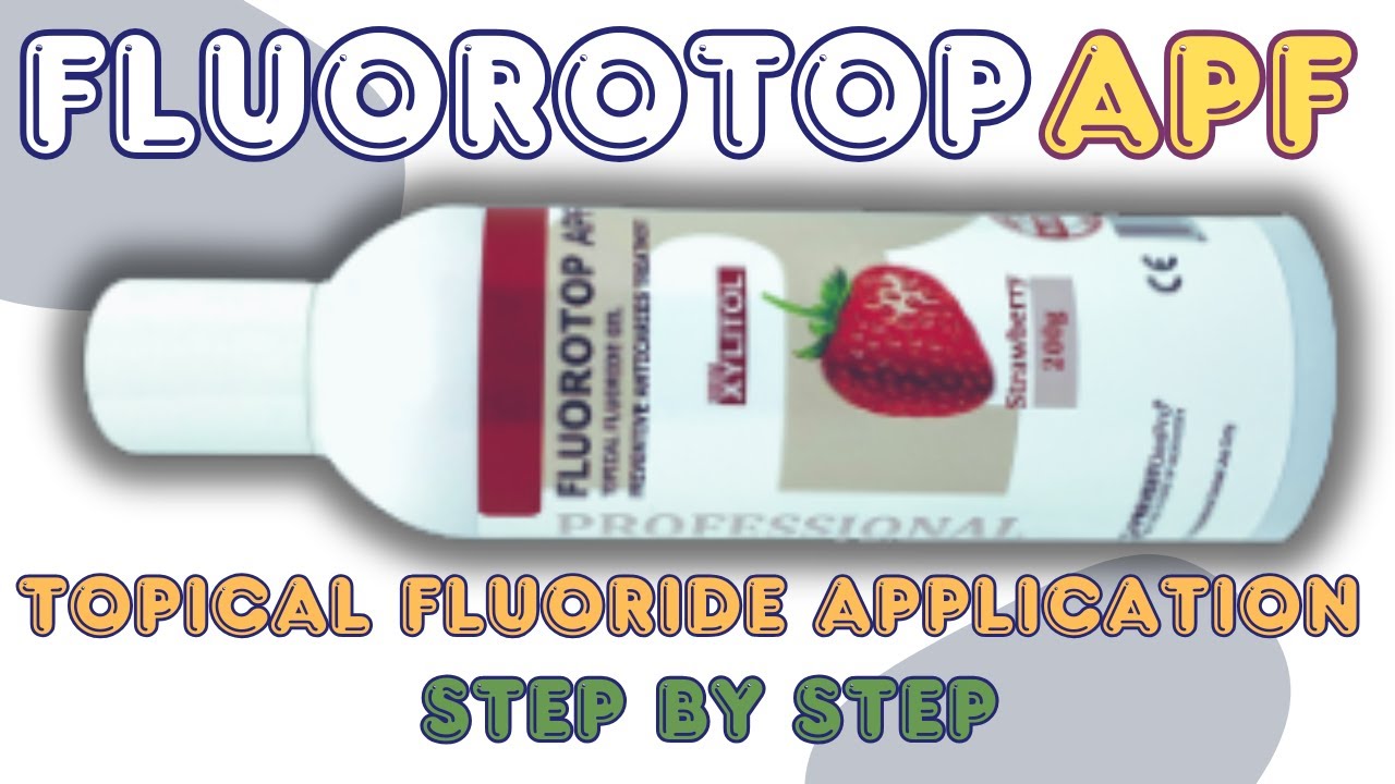 Topical Fluoride Application 🔴 Fluorotop APF 🔵 Topical Fluoride Gel ⚪️ Demonstration Step By Step