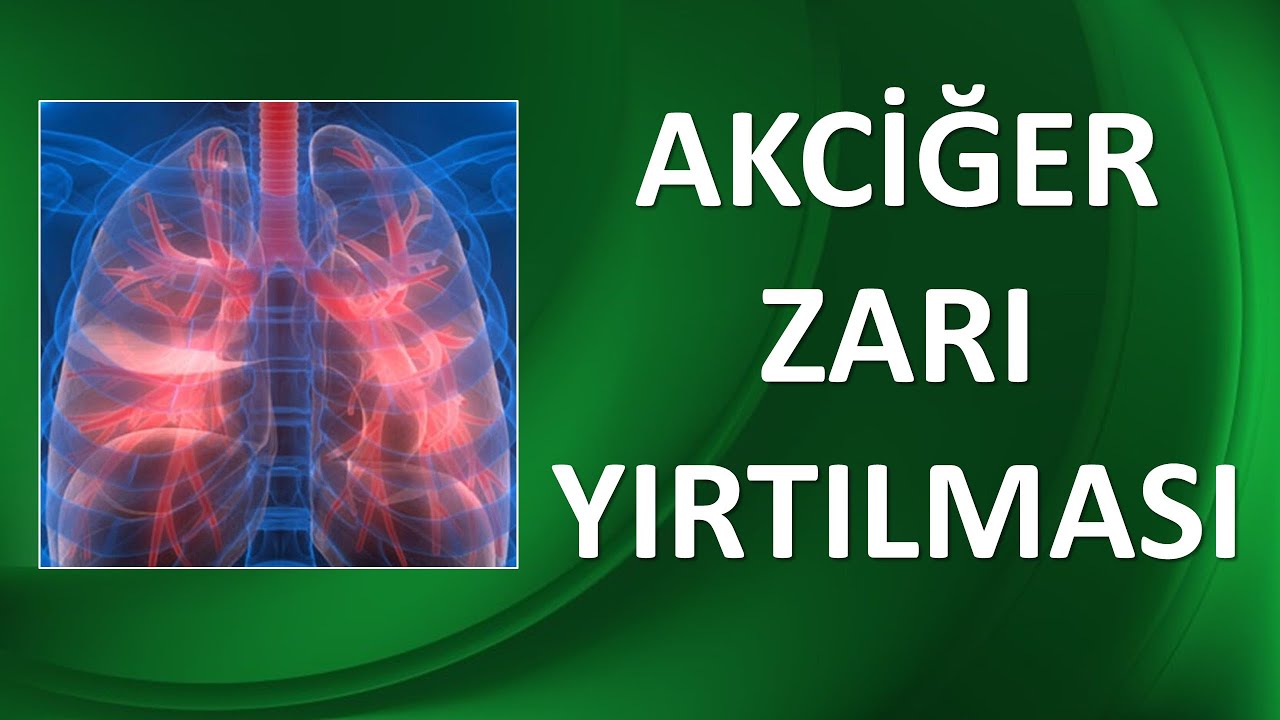 PNÖMOTORAKS-AKCİĞER ZARI YIRTILMASI