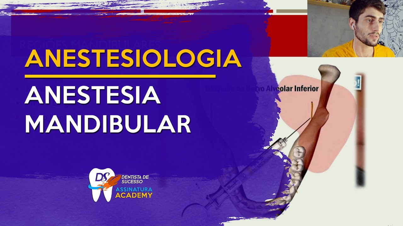 Como anestesiar o nervo alveolar inferior | Anestesiologia para dentista