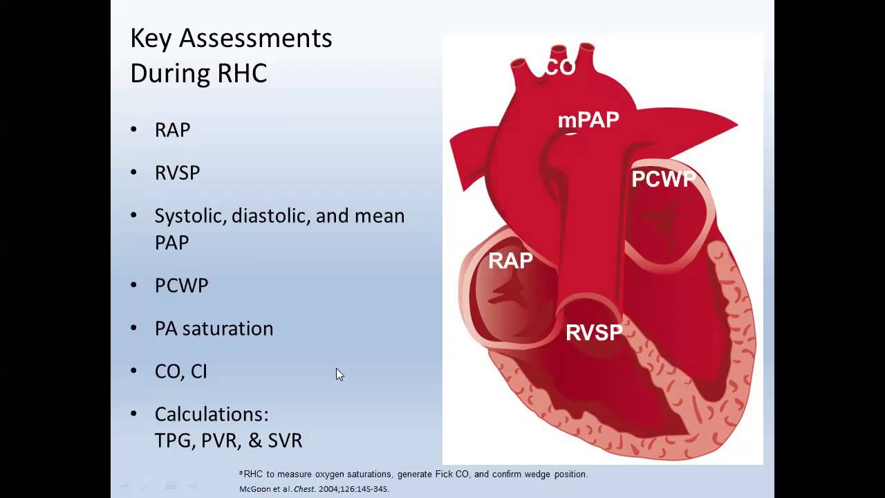Nuts and Bolts of Right Heart Catheterization