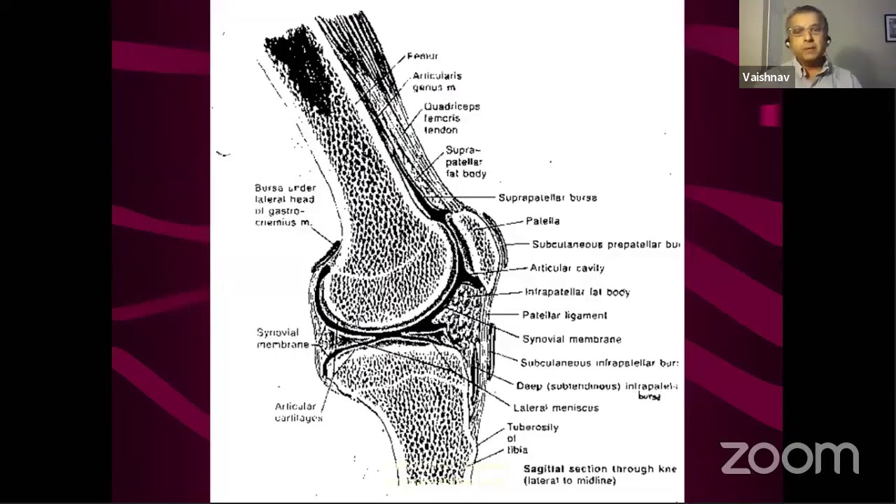 Homeopathy in Musculo Skeletal disorders