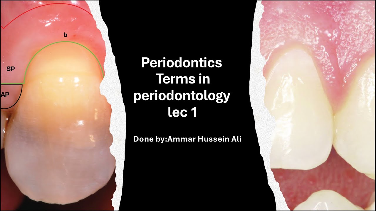 Terms in Periodontology for 4th stage part 1  بريو وزاري مرحلةً رابعة