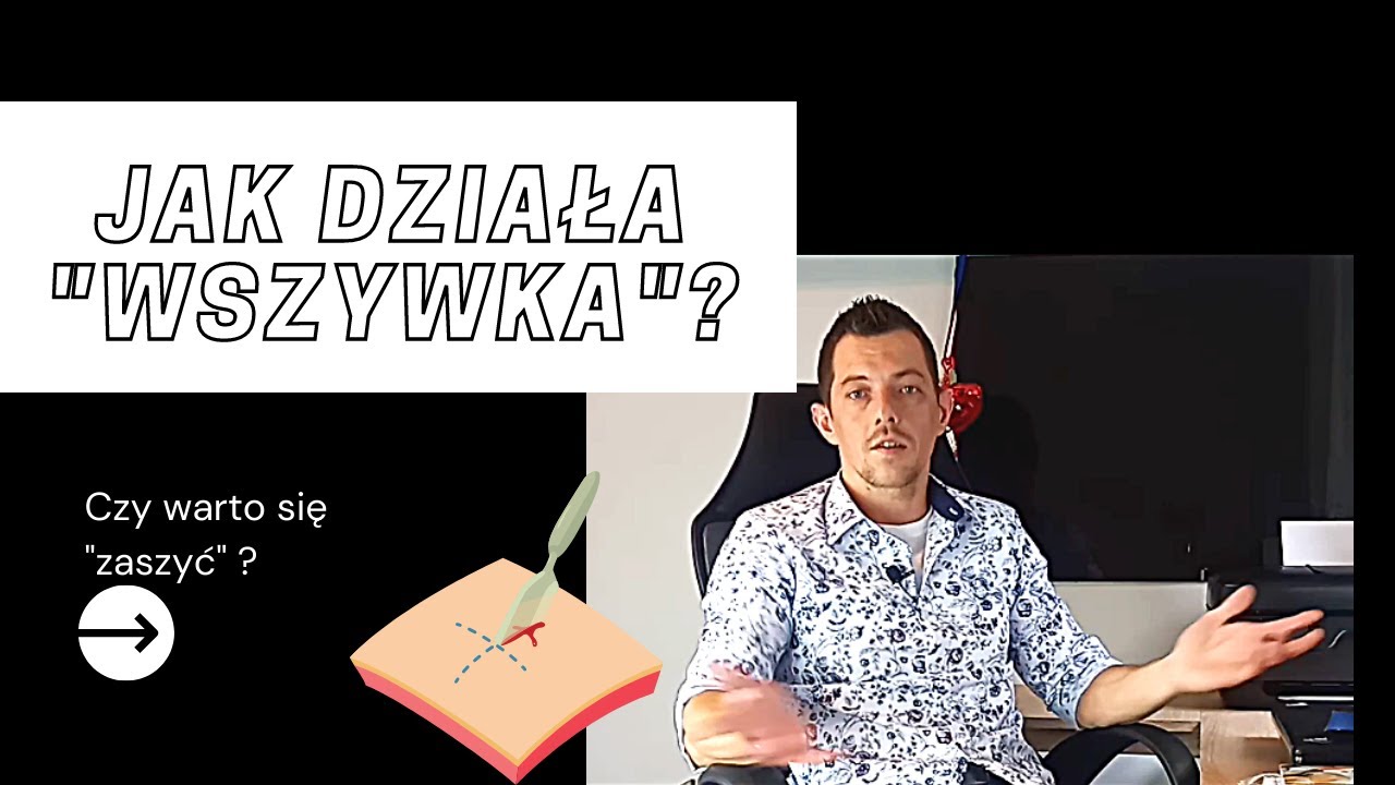 JAK DZIAŁA ''WSZYWKA''? ESPERAL DISULFIRAM - CZY WARTO SIĘ ZASZYĆ?