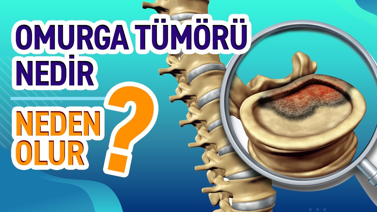 Omurga Tümörü Nedir? Belirtileri ve Tedavisi - Profesör Doktor Gökhan Demirkıran