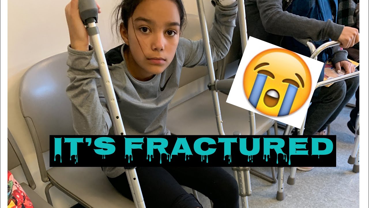 Gianna fractured her ankle