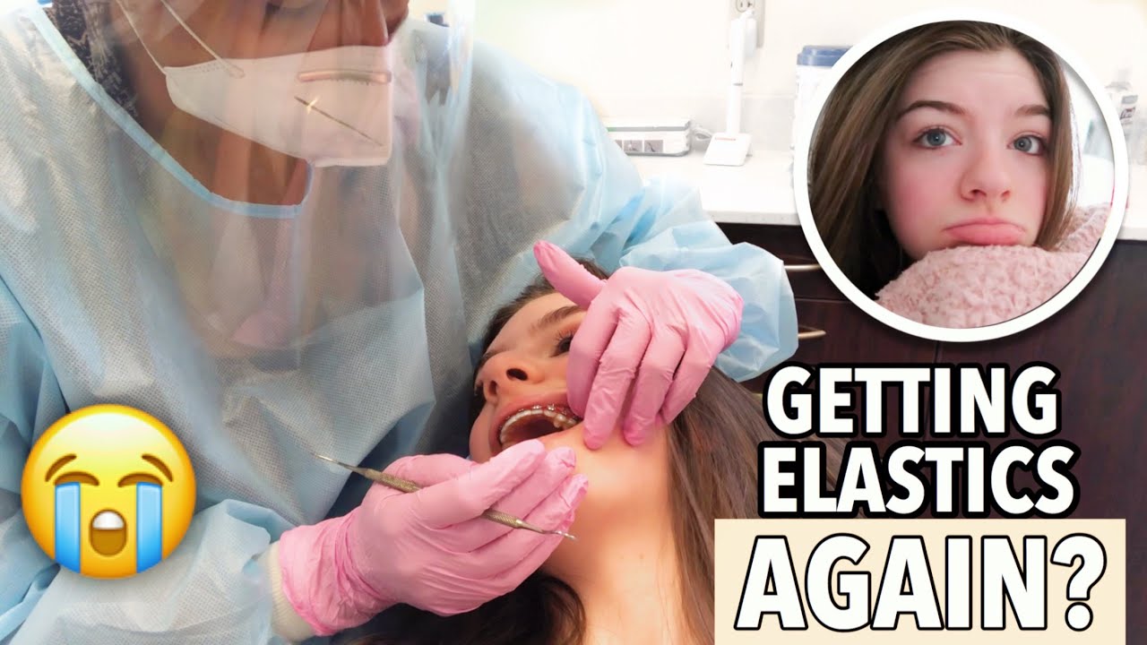 GETTING ELASTICS ON MY BRACES AGAIN *painful* | Lauren Hennessy