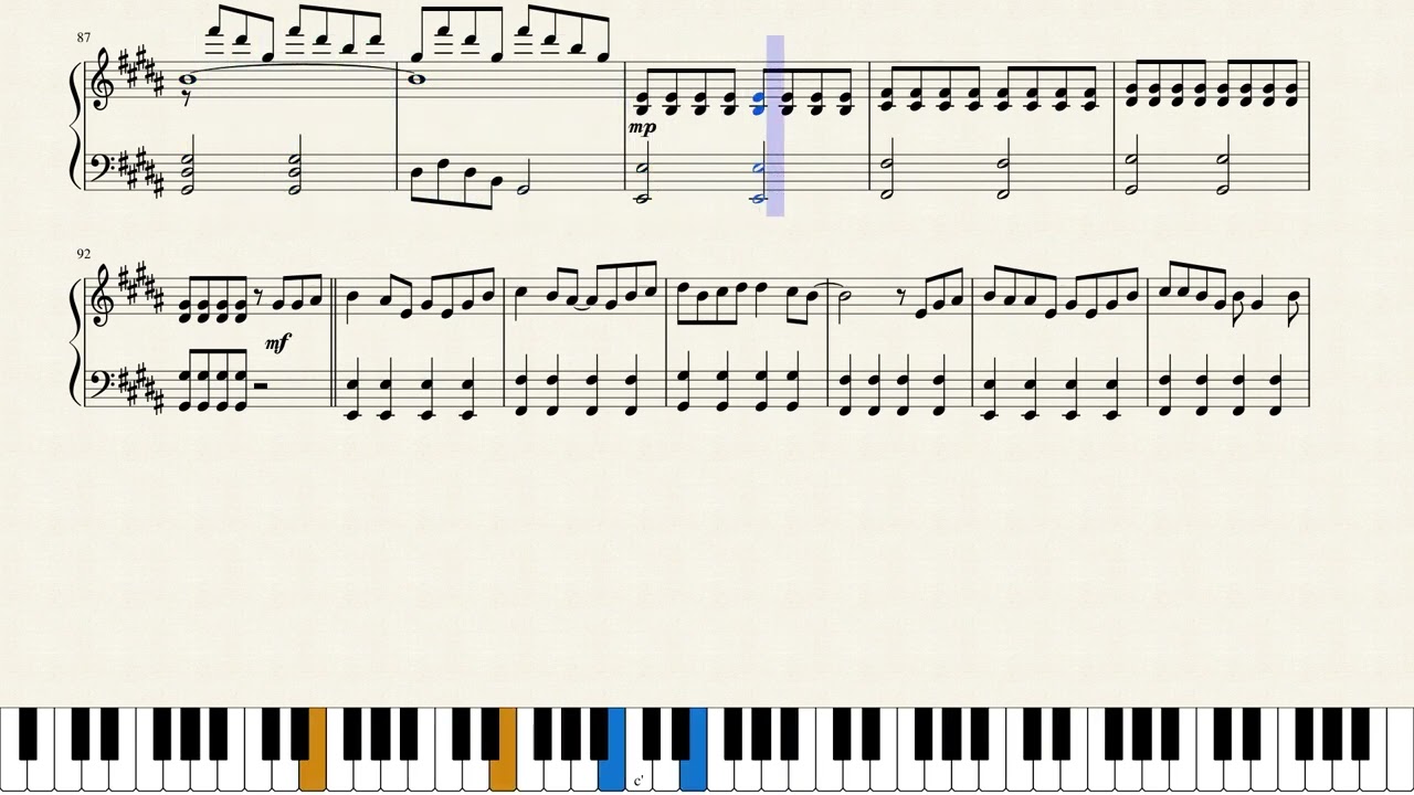 Drug of Gold (vocaloid song) - intermediate by mothy Arr. Lilianialoy