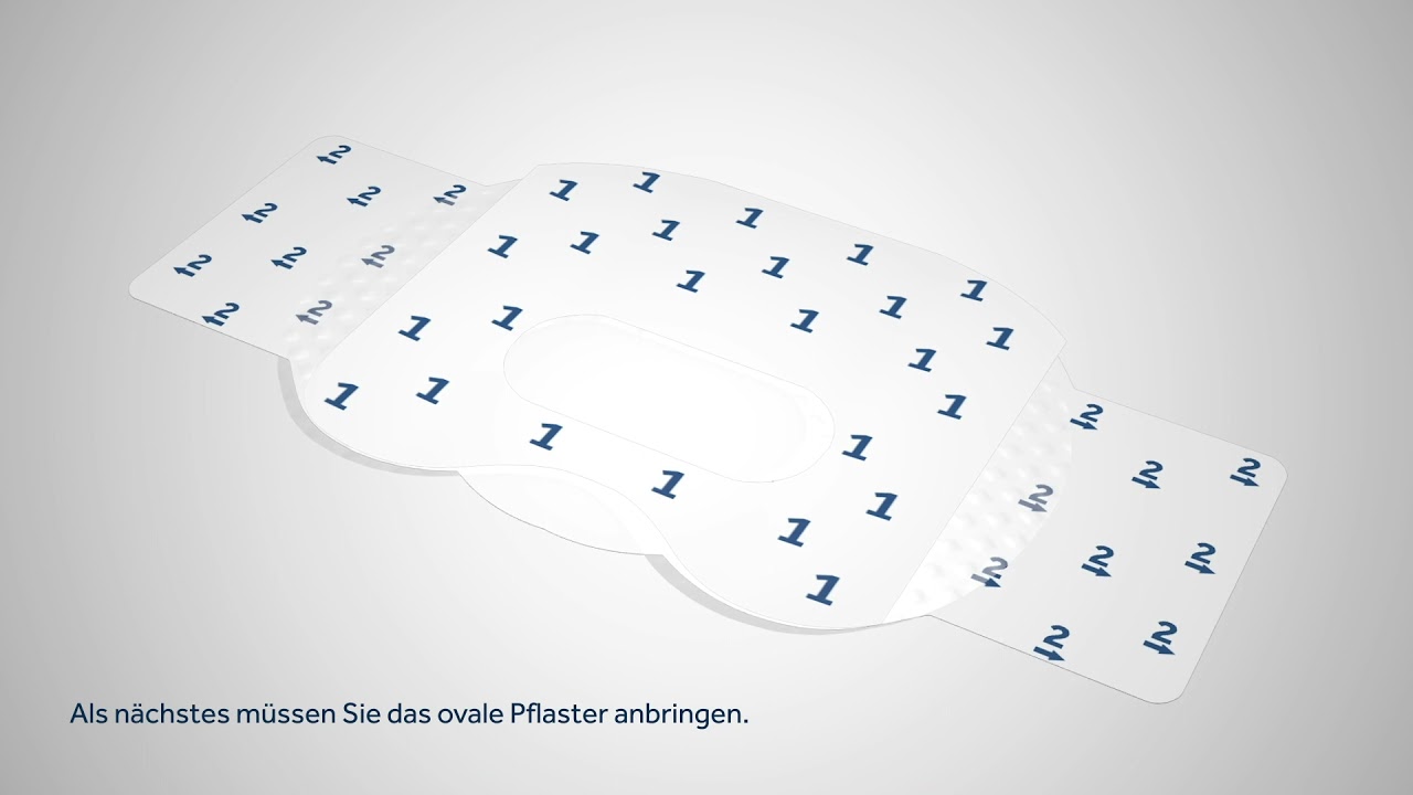 Setzen des Guardian™ 4 Sensors an der Armrückseite