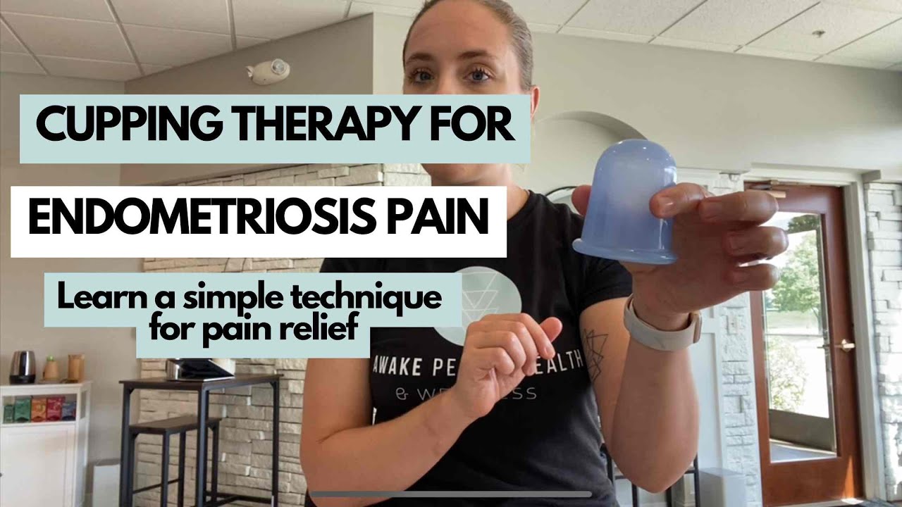 Cupping Therapy for Endometriosis  |  Gentle Endo Pain Relief