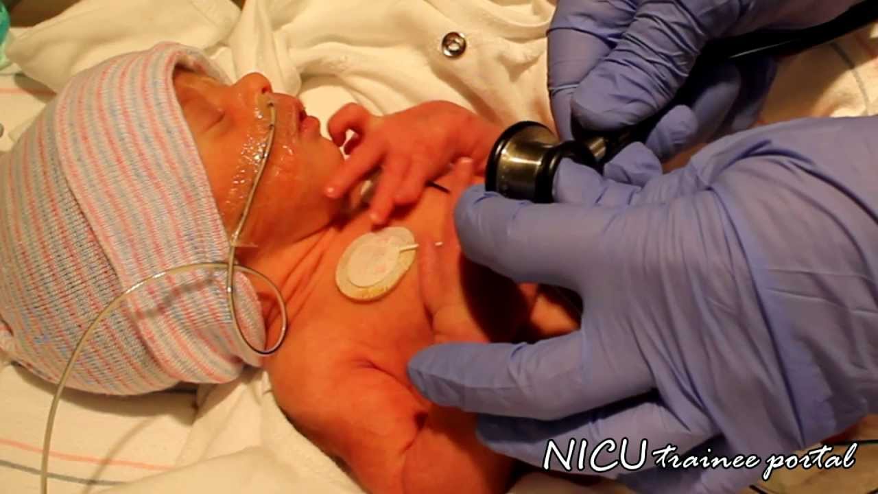 Physical Exam- 31 weeks gestation preterm infant