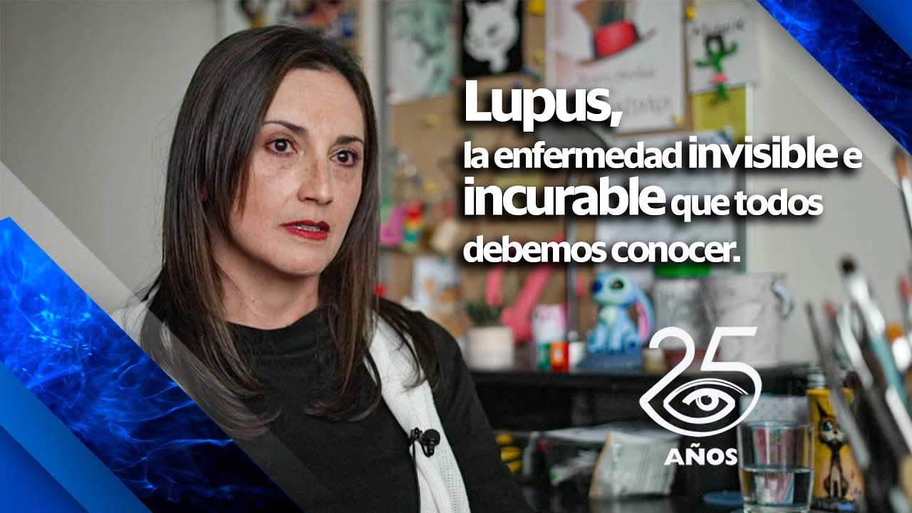 Lupus, la enfermedad invisible e incurable que todos debemos conocer - Día a Día - Teleamazonas