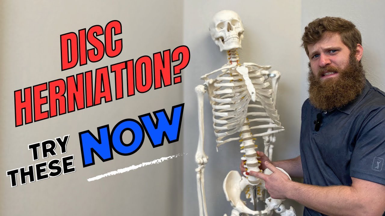 ✅ Disc Herniation Relief ✅ | Chiropractor | Kennewick, WA