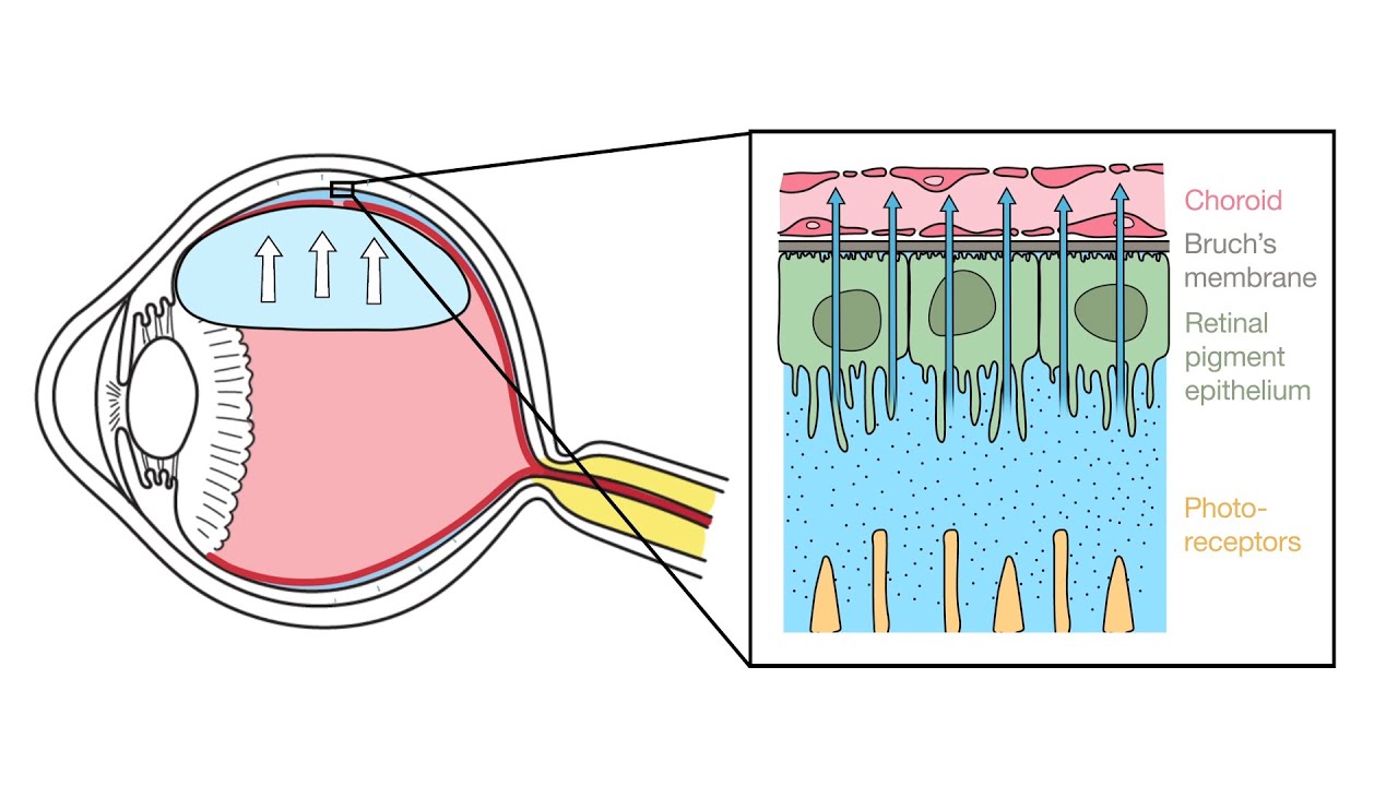 Mechanism of Retinal Reattachment Following Pneumatic Retinopexy