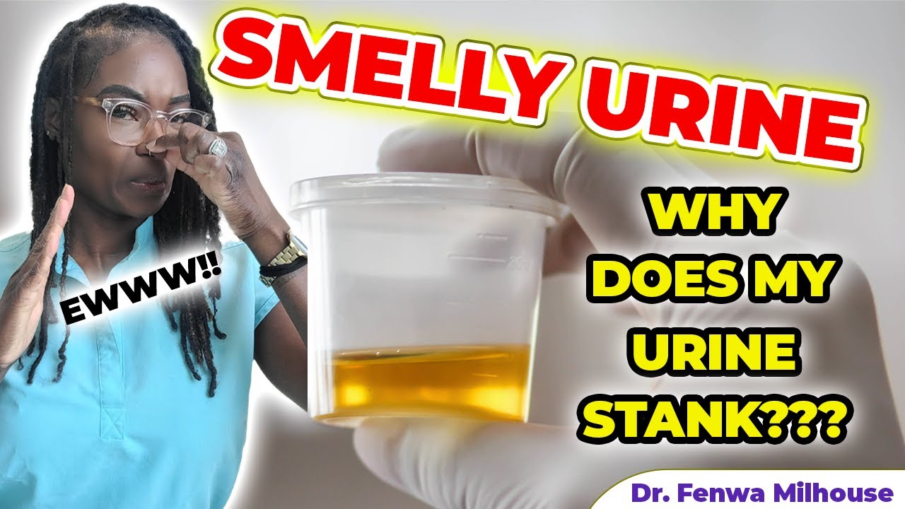 SMELLY URINE | CAUSES WHY YOUR URINE STANK | Dr. Milhouse