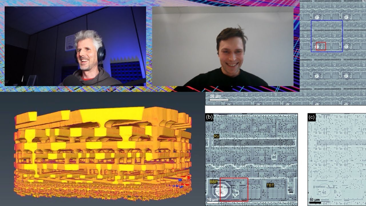 using X-rays to make 3D images of chips with Tomas Aidukas