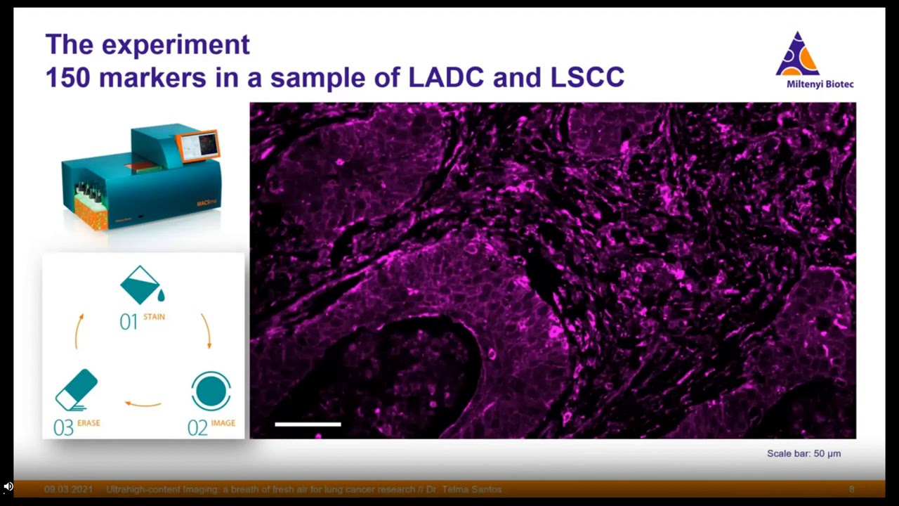 Ultrahigh content imaging  a breath of fresh air for lung cancer research 1