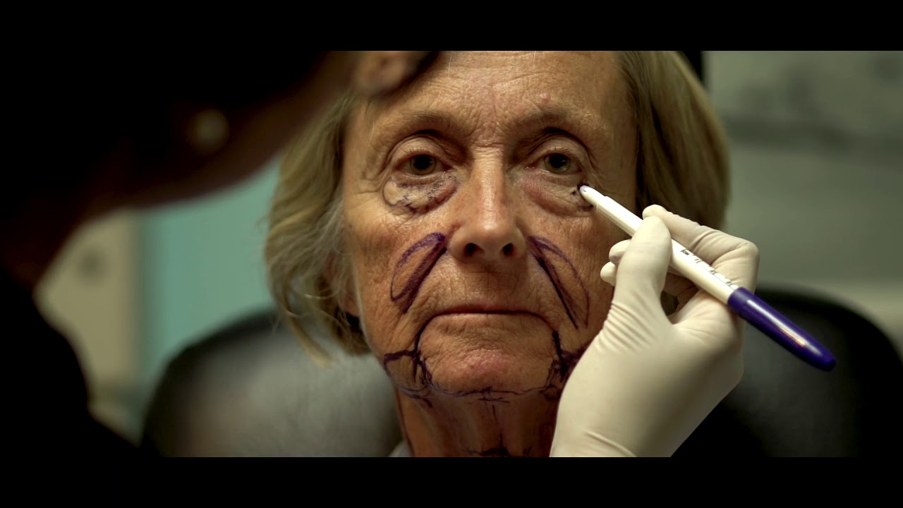 Facetite/Accutite/Morpheus8 Testimonial Video