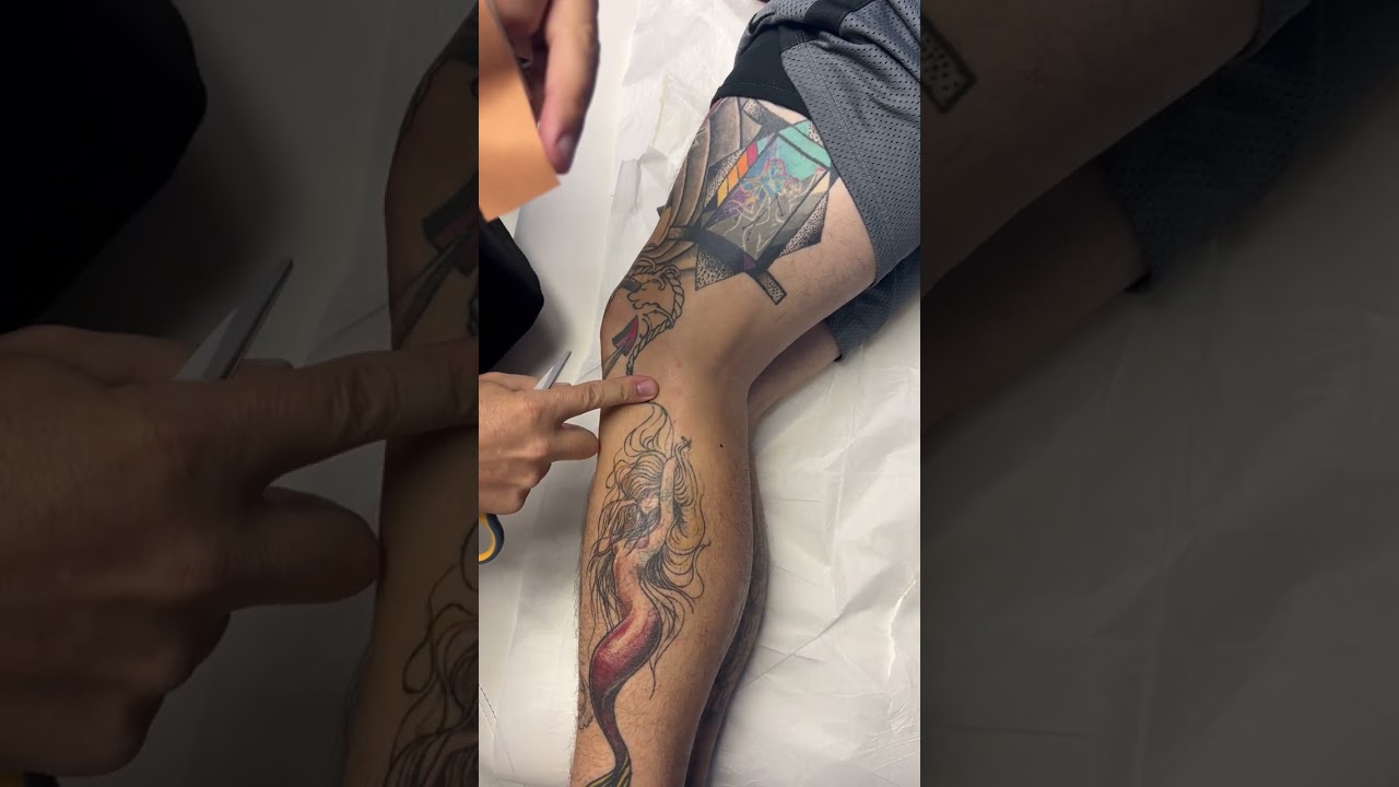 Lateral Collateral Ligament taping