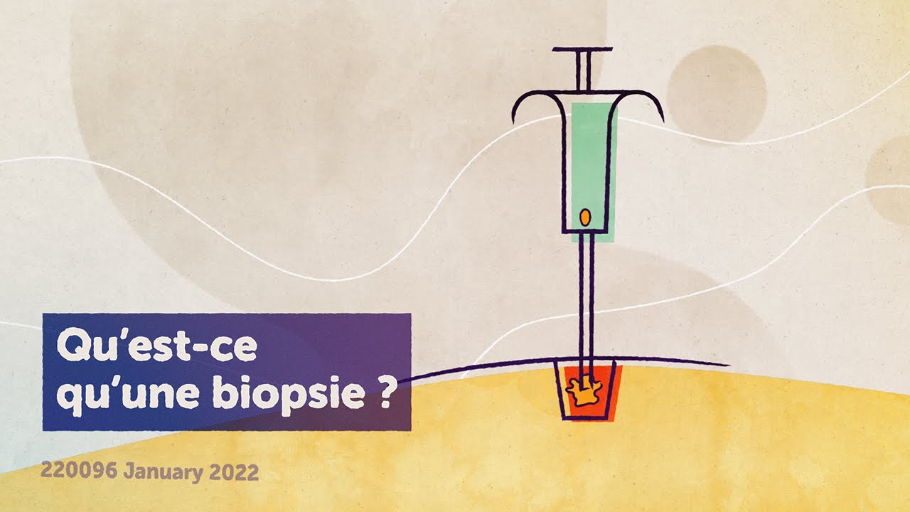 Quels sont les outils diagnostiques ?