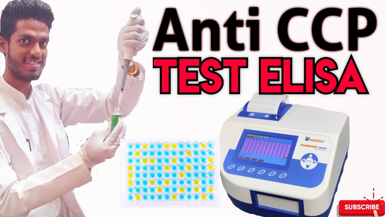 anti ccp test ELISA Procedure #lab#ytvideo#laboratory #medical