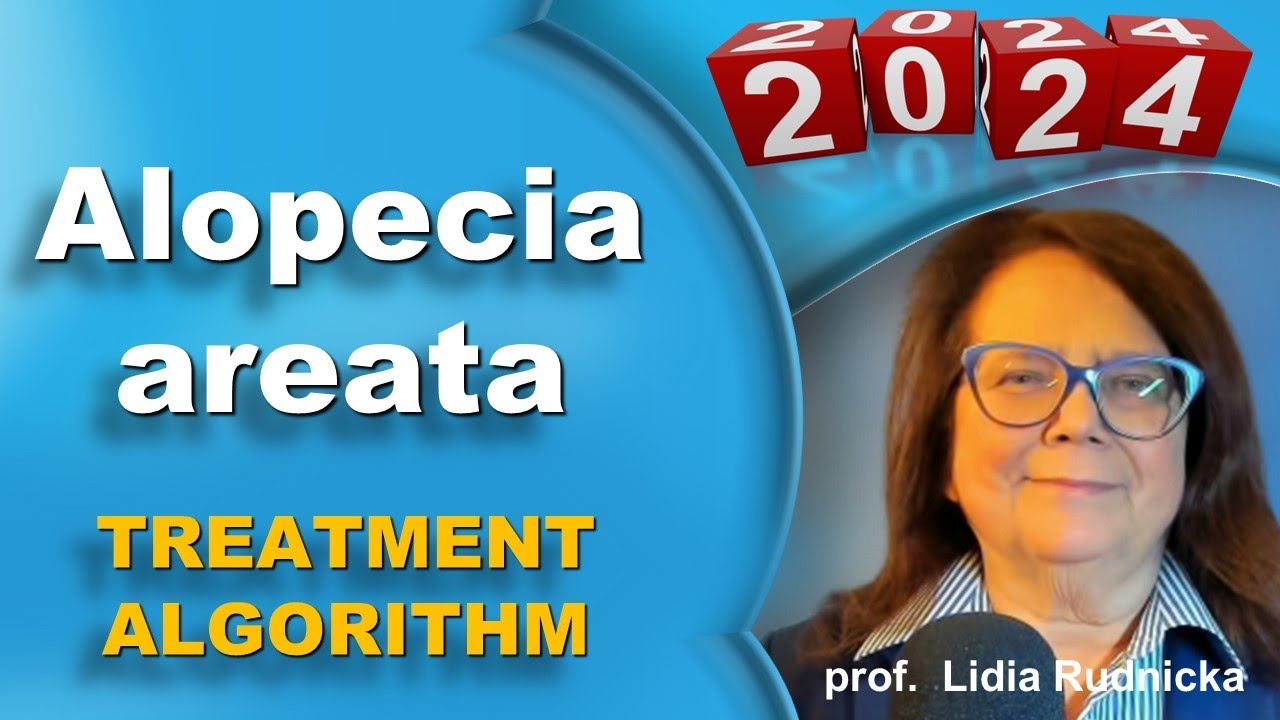 European Experts Share The Alopecia Areata Systemic Treatment Algorithm