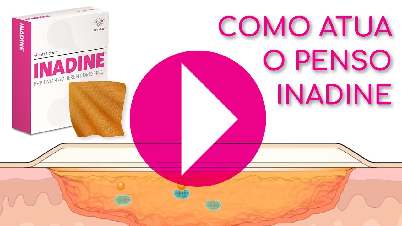 Vídeo Ilustrativo de como o Inadine Atua Sobre a Ferida