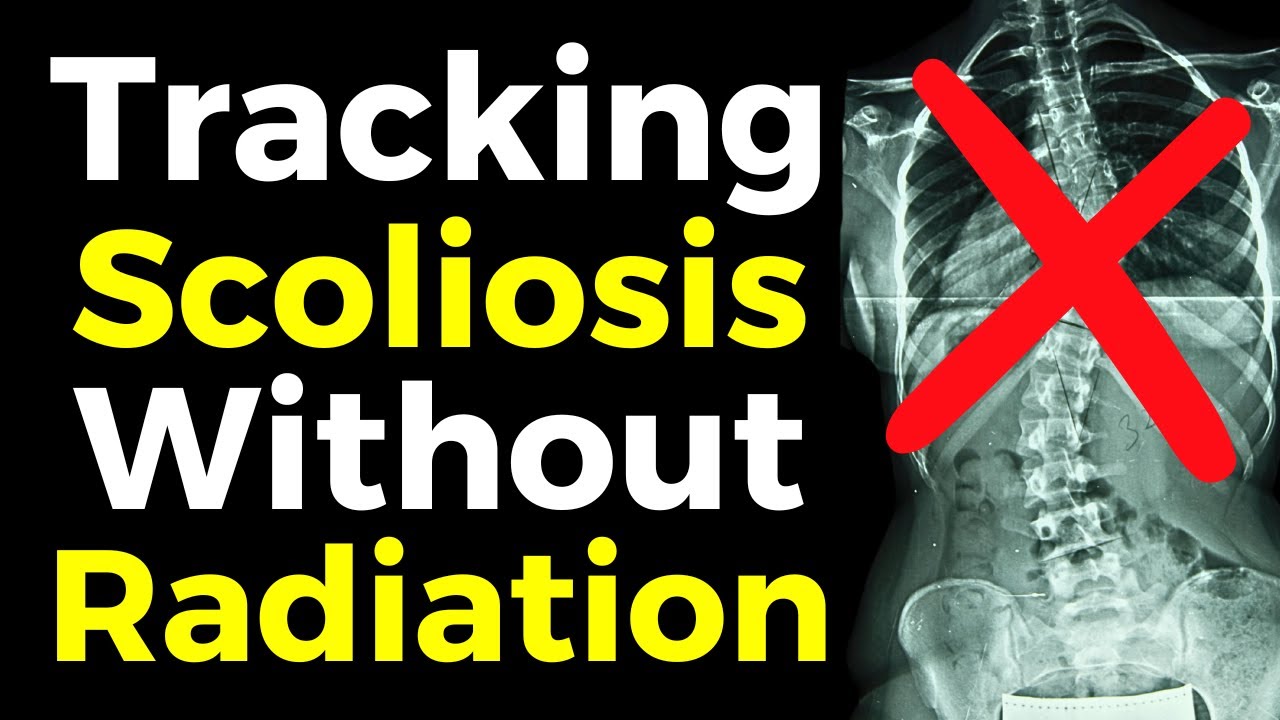 How To Monitor Scoliosis Progression Without X-Rays | Ahead of the Curve