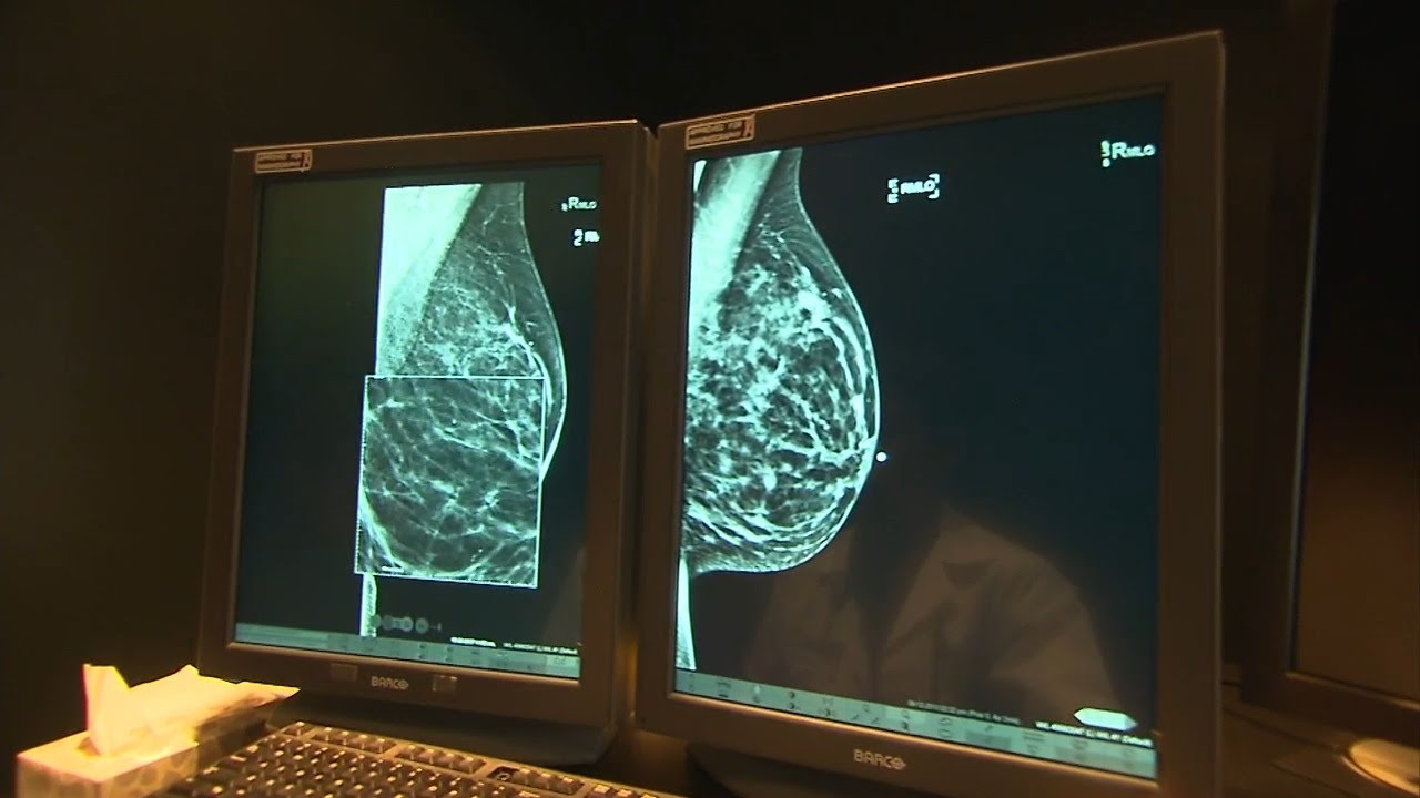 Health Minute: New rule requires notice after a mammogram