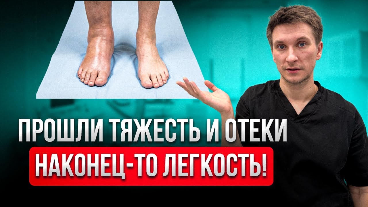 Она сделала ЭТО, и ОТЕКИ ПРОШЛИ! Больше никакой тяжести и боли в ногах!