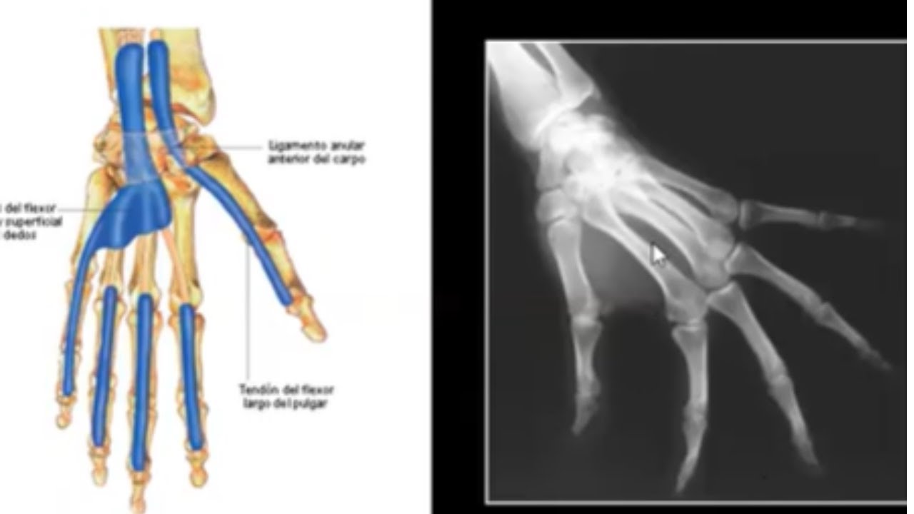 Anatomia Radiológica da mão