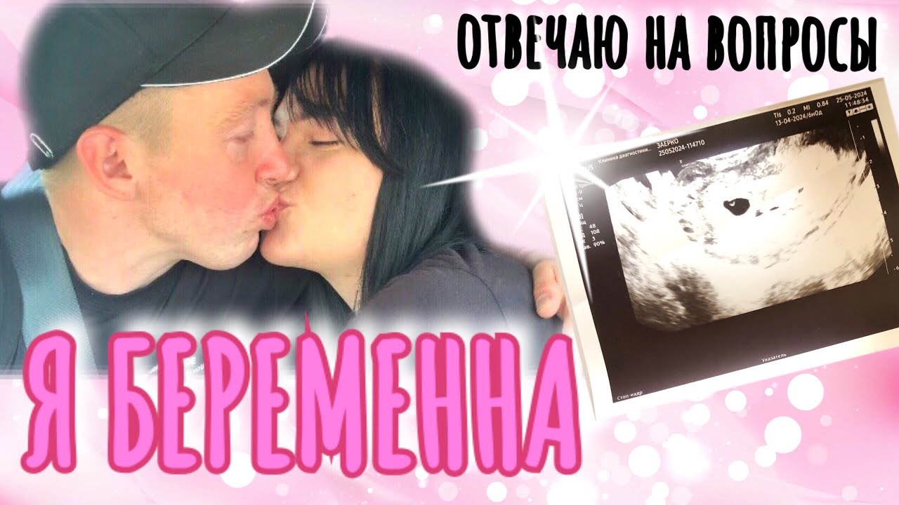 Я БЕРЕМЕННА. ОТВЕЧАЮ НА ВОПРОСЫ. РЕЗУЛЬТАТ ПЕРВОГО УЗИ. ПОЛОЖИЛИ В БОЛЬНИЦУ😮…