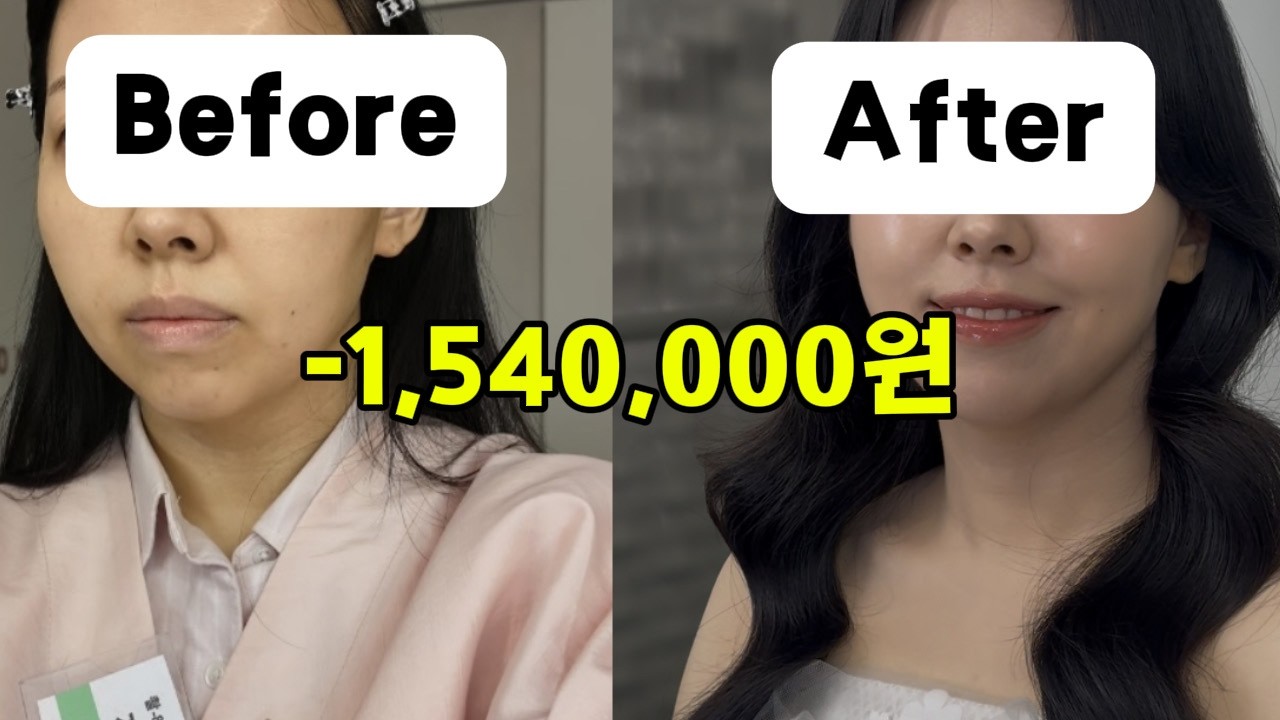웨딩메이크업 154만원…건성 피부+얼굴 흉터 솔직 후기