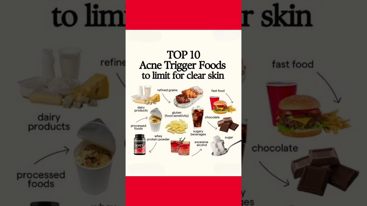 Struggling with acne? 😩