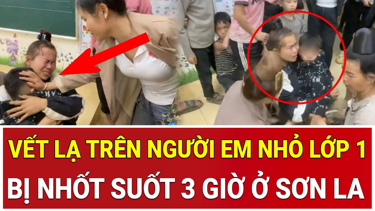 Vết lạ trên người em nhỏ lớp 1 bị nhốt suốt 3 giờ ở Sơn La: Hé lộ tình tiết rùng mình