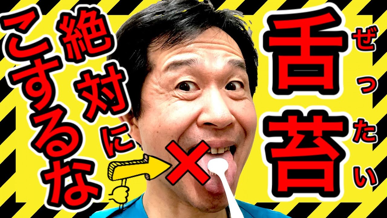 【舌苔は絶対こするな‼︎①】6つの舌苔の原因 を歯科医が徹底解説！！仕事中◯◯しない人は要注意‼︎