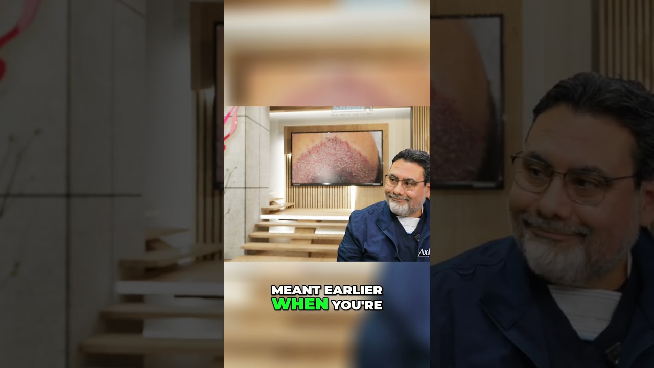 Hair Transplant: Master Graft Angle for Natural Results! 