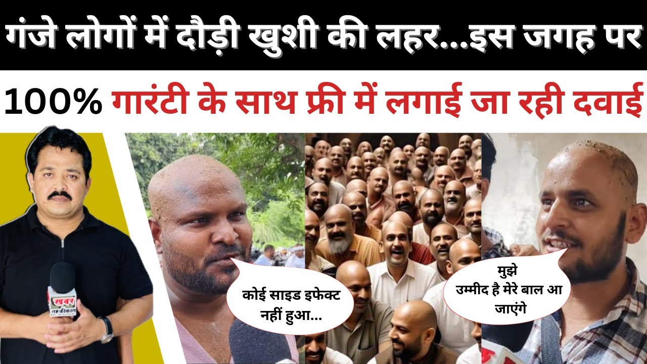 गंजे लोगों में दौड़ी खुशी की लहर...इस जगह पर 100% गारंटी के साथ फ्री में लगाई जा रही दवाई #news