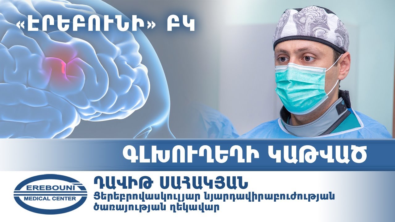 Գլխուղեղի կաթված. ախտանշանները