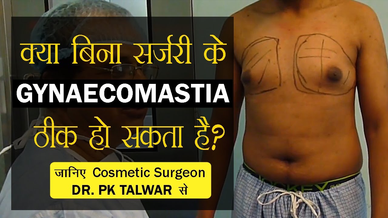 Можно ли вылечить гинекомастию без операции? PK Talwar — Операция по удалению гинекомастии в Дели