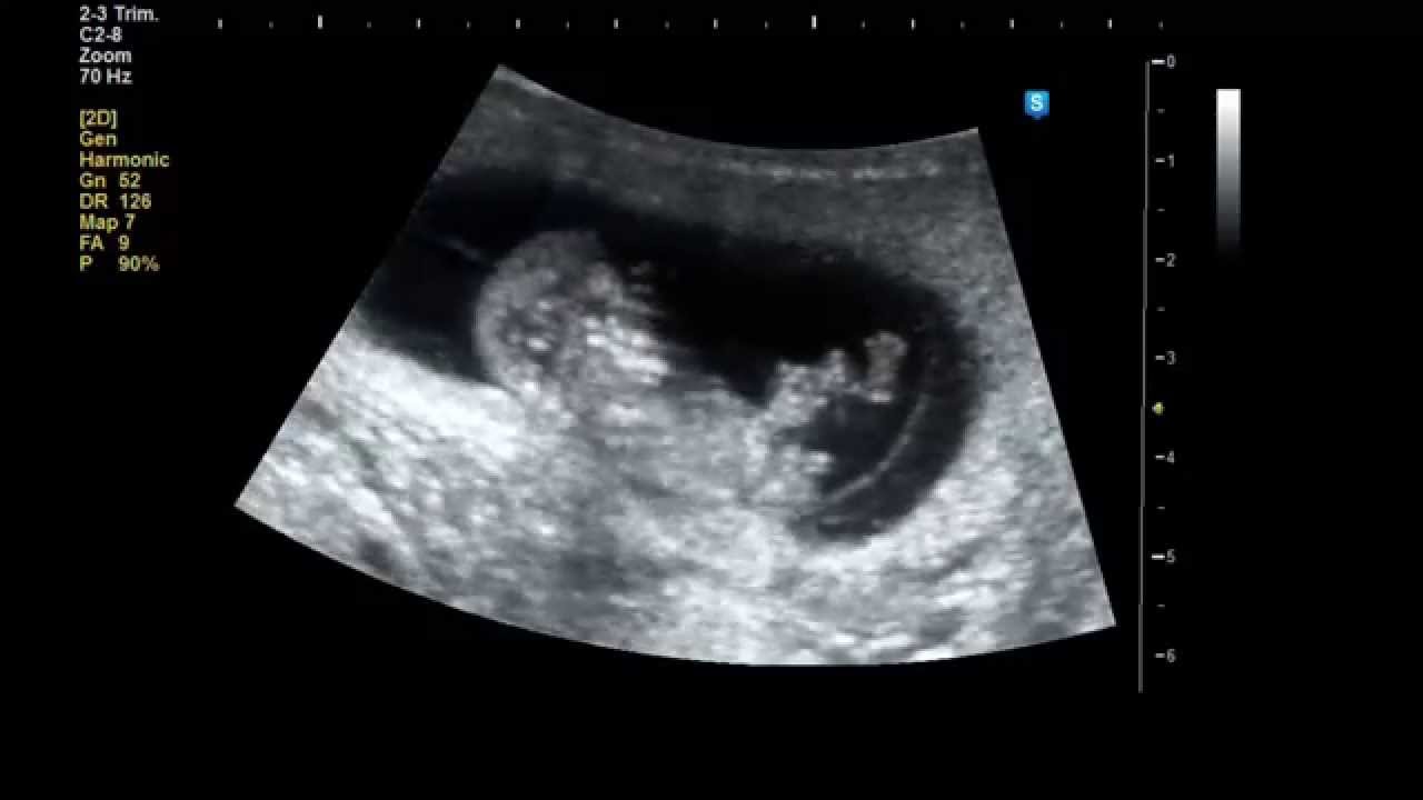 Our baby in 13 weeks,amazing experience