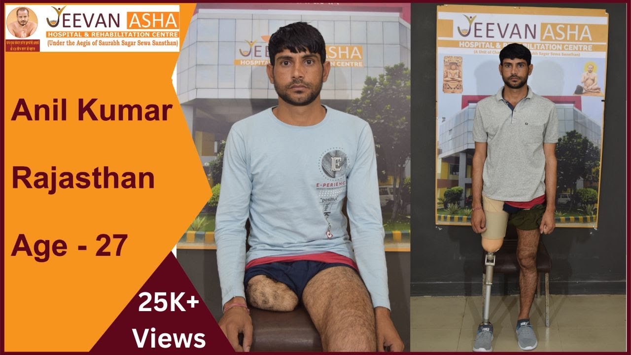 Mr. Anil Kumar from Rajasthan lost his right leg above knee in a accident, free of cost prosthesis